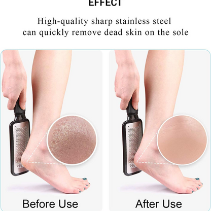 Black Foot Rasp File Callus Remover Stainless Steel Hard Dead Skin Scrubber